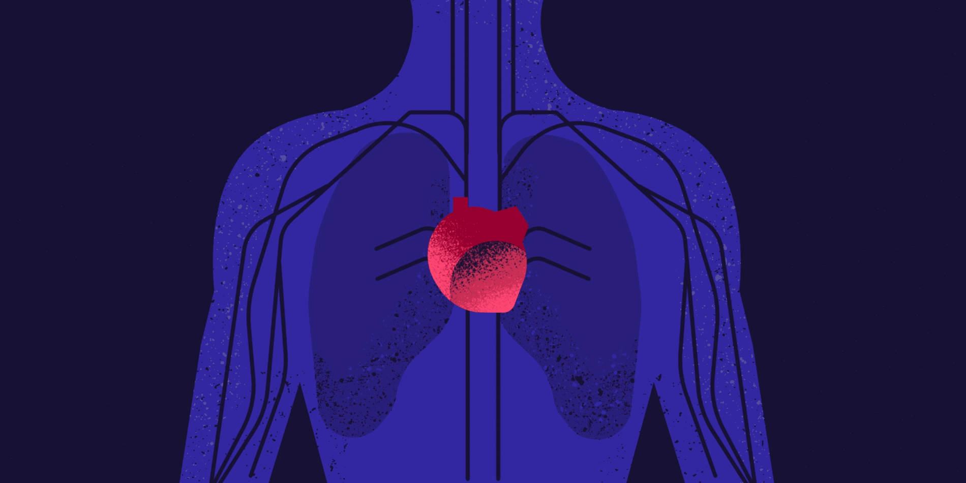 
An ability to better measure blood flow could have a positive impact in multiple fields of surgery. | Illustration by Kevin Craft