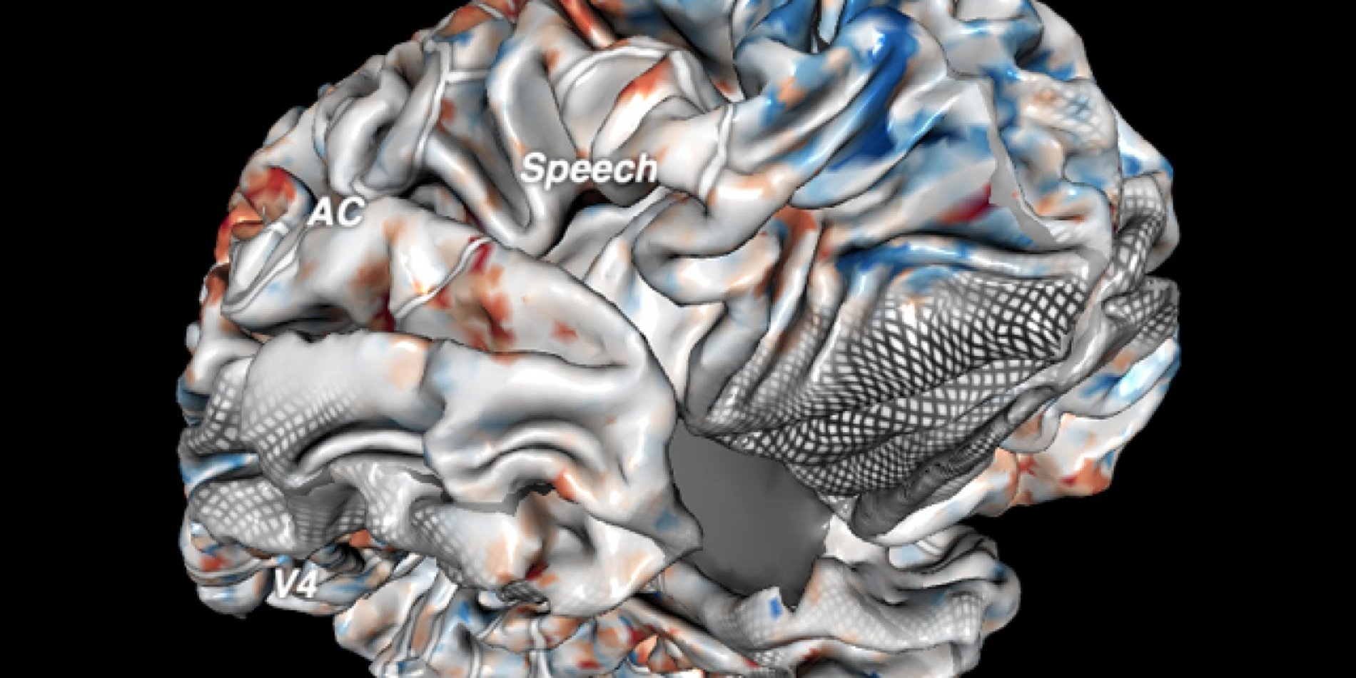 

	
		
			
				A JavaScript web graphics library called Three.js powers a sophisticated MRI image of a brain in 3D | Image courtesy of Gallant Neuroscience Lab at UC Berkeley
			
		
	

 