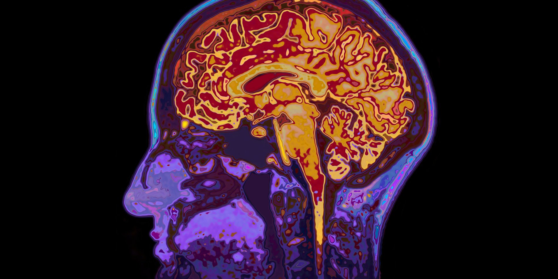 Vibrant, colorful illustration of a human brain.