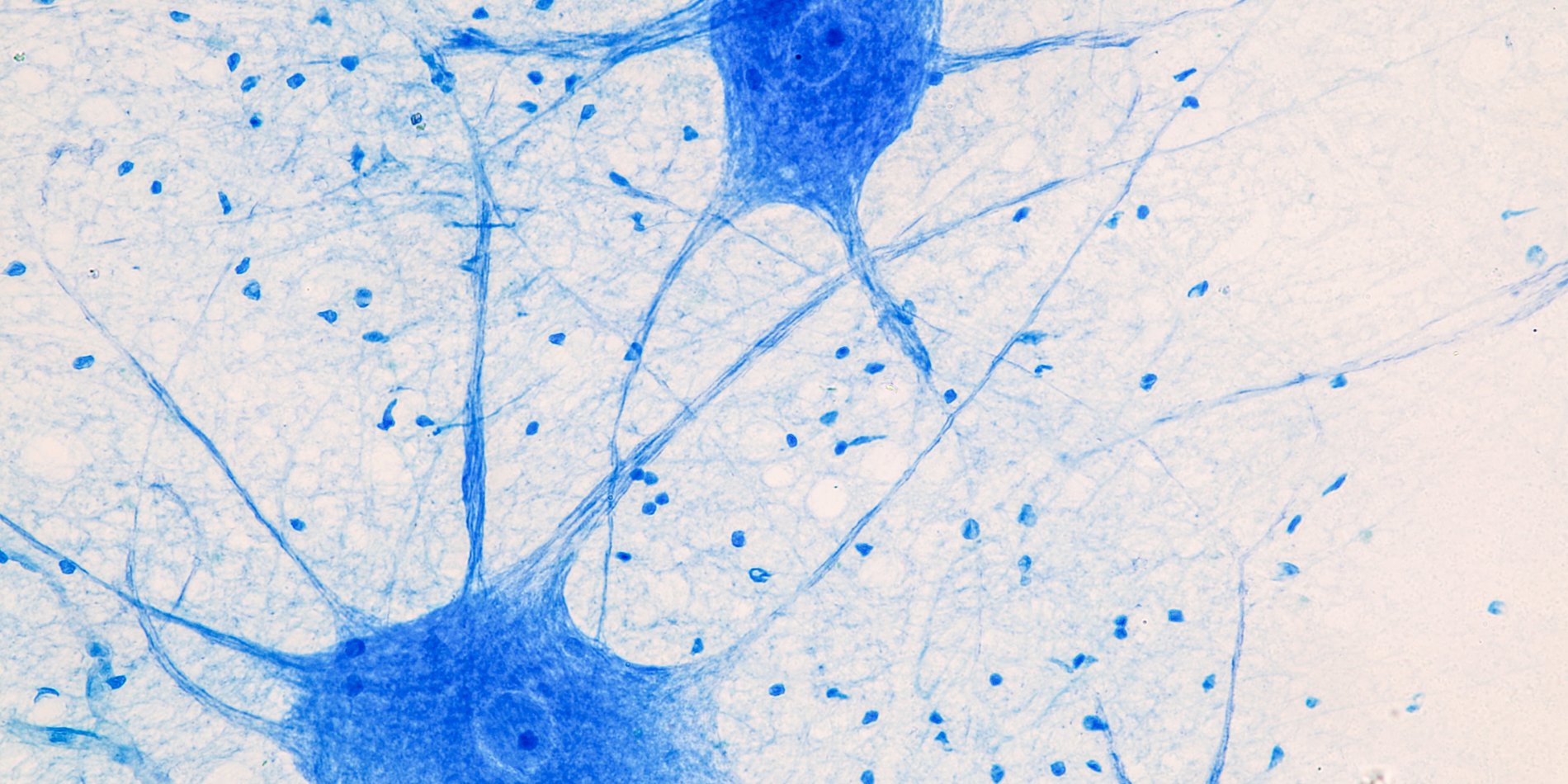 Motor Neuron under the microscope in a lab.