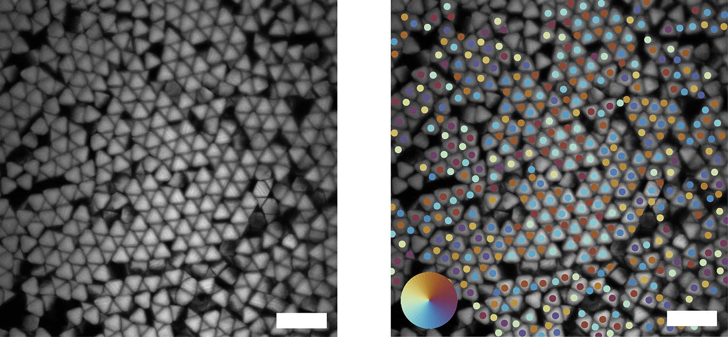 Microscopic view of colored quasi-diamond structures.